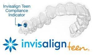 best of Teen the clear Invisalign
