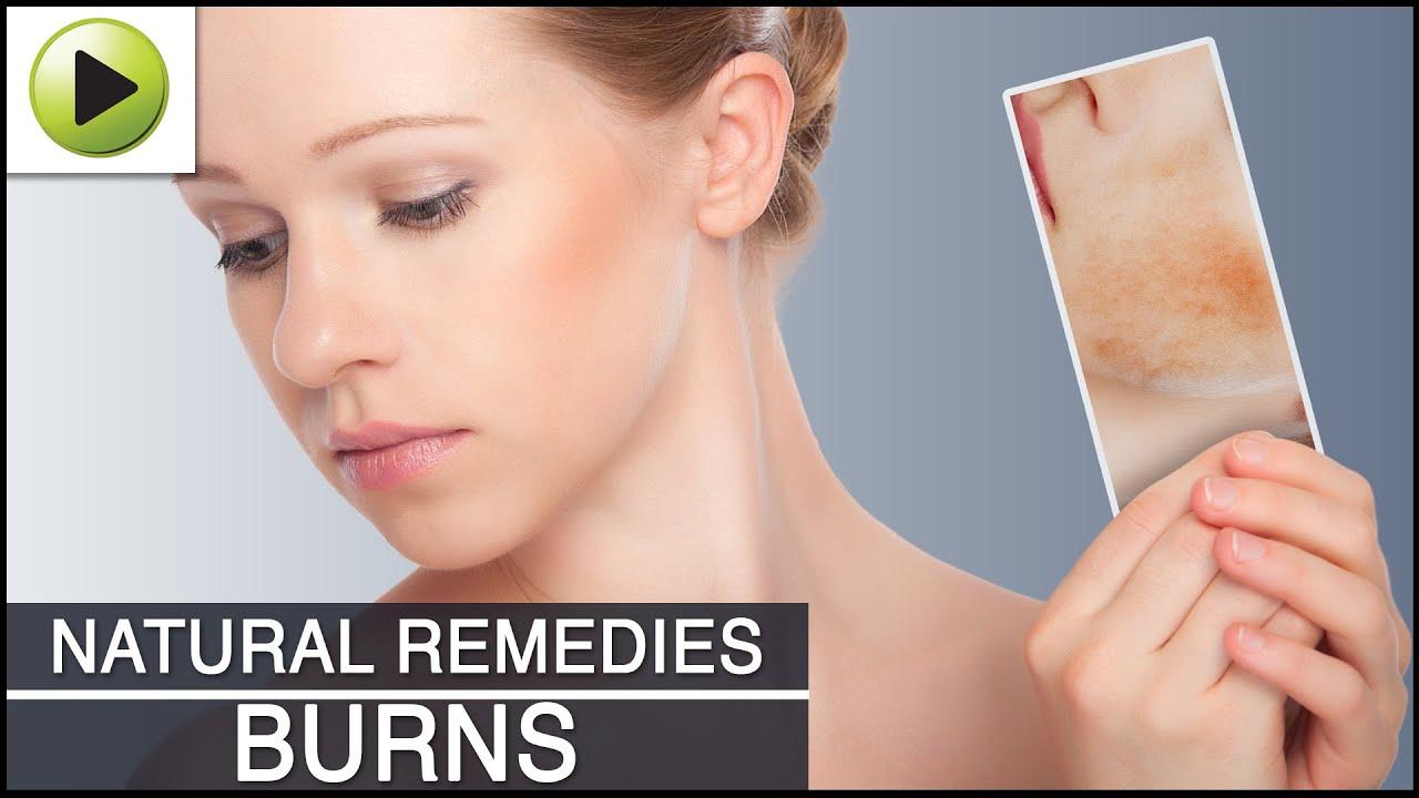 The P. reccomend Facial waxing burns treatment