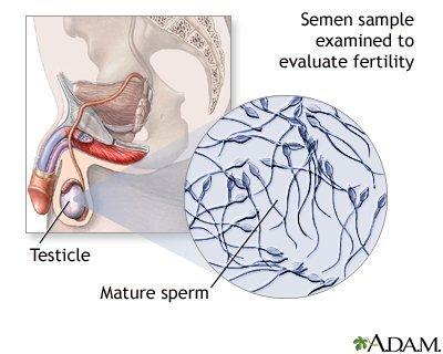 Ballgame reccomend Hypospadias affecting sperm delivery