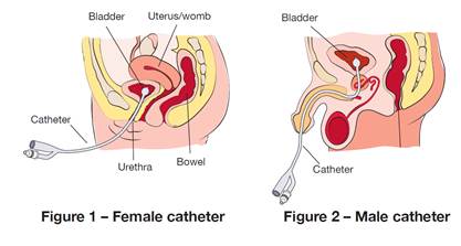 best of Push hole pee Urethral through