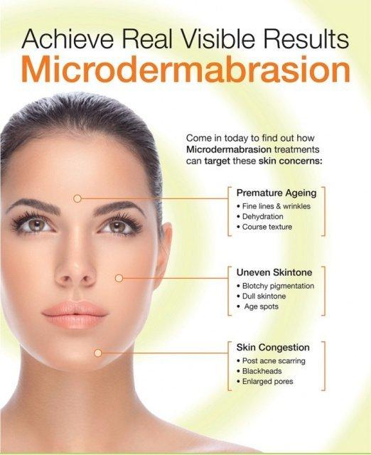 best of Microdermabrasion Facial with
