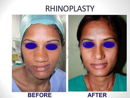 Cost facial plastic surgery