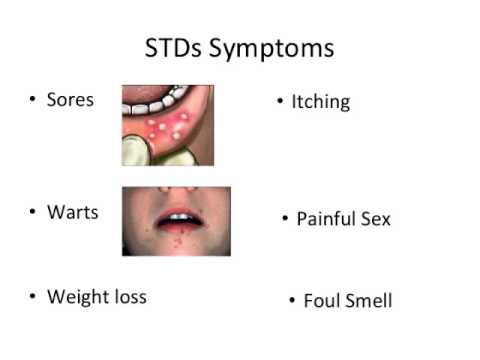 Ace reccomend Oral sex and sexually transmitted disease