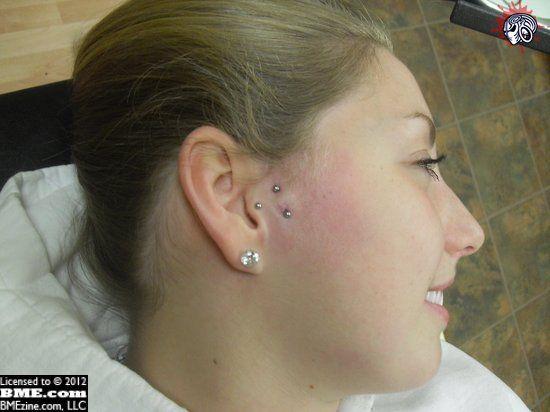 Facial surface piercings