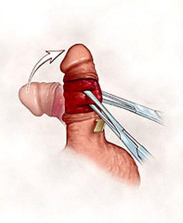 Free male anal probing pic