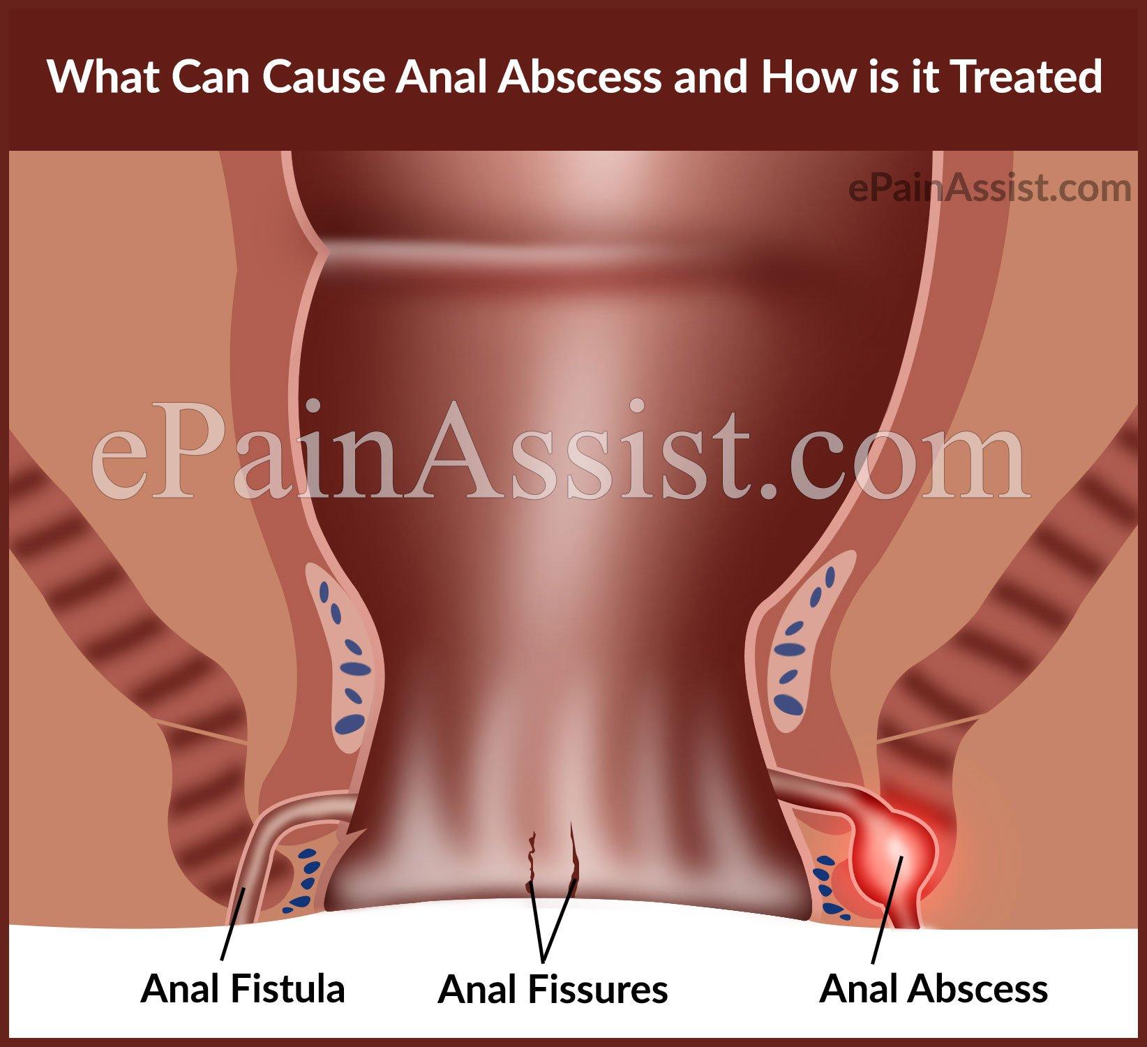 Causes of throbbing in anus