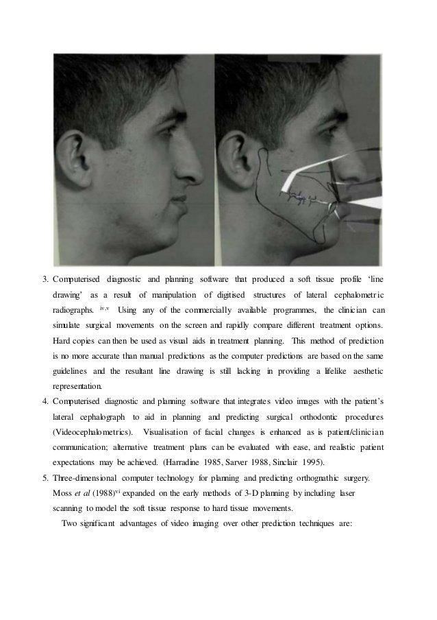 Ember reccomend Computer generated facial measurements for orthodontics