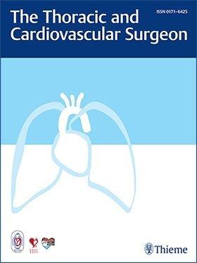 Subwoofer reccomend Asian cardiovascular & thoracic annals