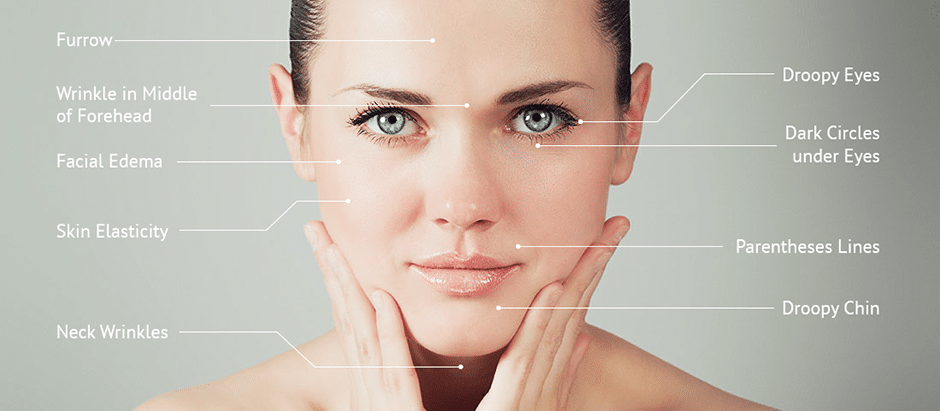 Lincoln reccomend Acupuncture facial meridians