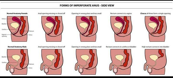 Anus pain bowel movements