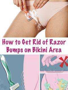 Bikini shave bumps