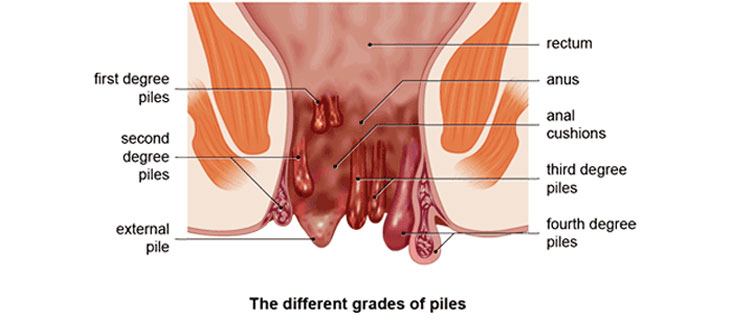 Mr. P. reccomend Causes of throbbing in anus