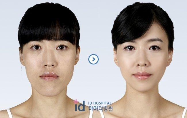 Cost facial plastic surgery