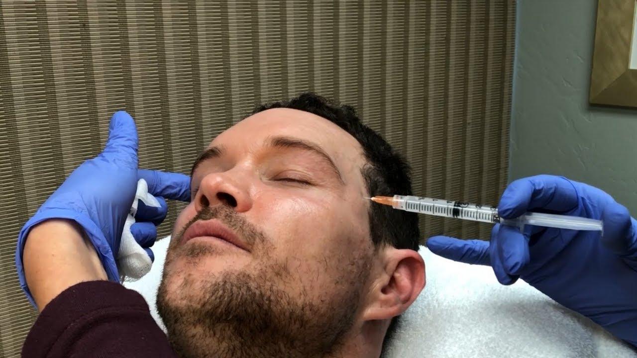 Vice reccomend Don stroud facial scar