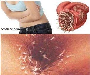 Human parasite boob