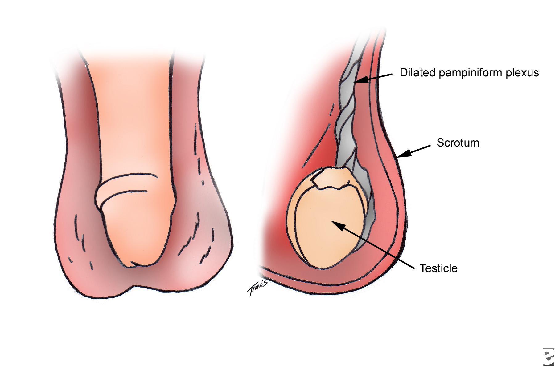 Soda P. reccomend Eunuch testicles ovaries she vagina piss