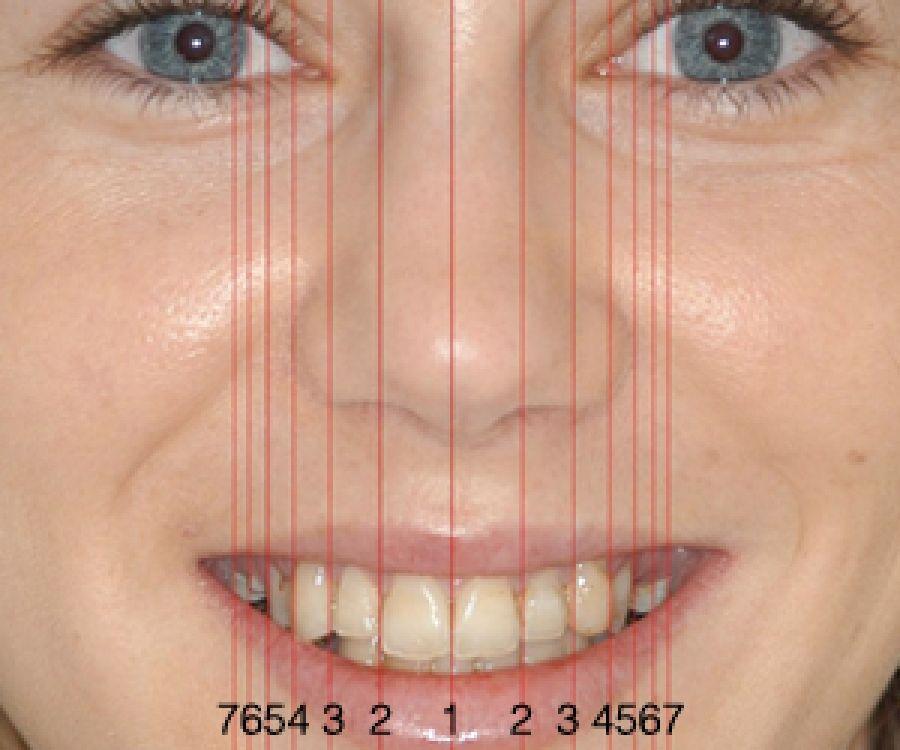 best of For facial Computer orthodontics measurements generated