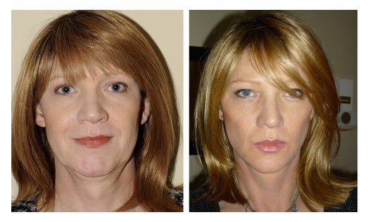 best of Programs Facial exercise