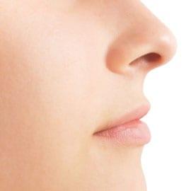 best of Veins causes varicose Facial