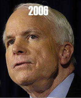 Gingersnap reccomend John mccain left sided facial swelling