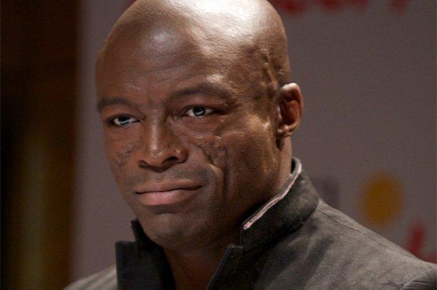 Seal and his facial scars