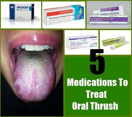 Treatment for adult oral yeast