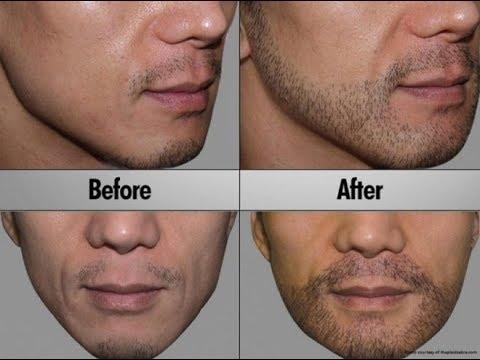Ways to enhance facial hair growth